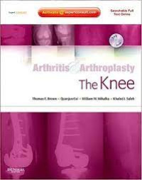 Image of Arthritis & Arthoplasty the Knee