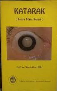Image of Katarak (Lensa Mata Keruh)